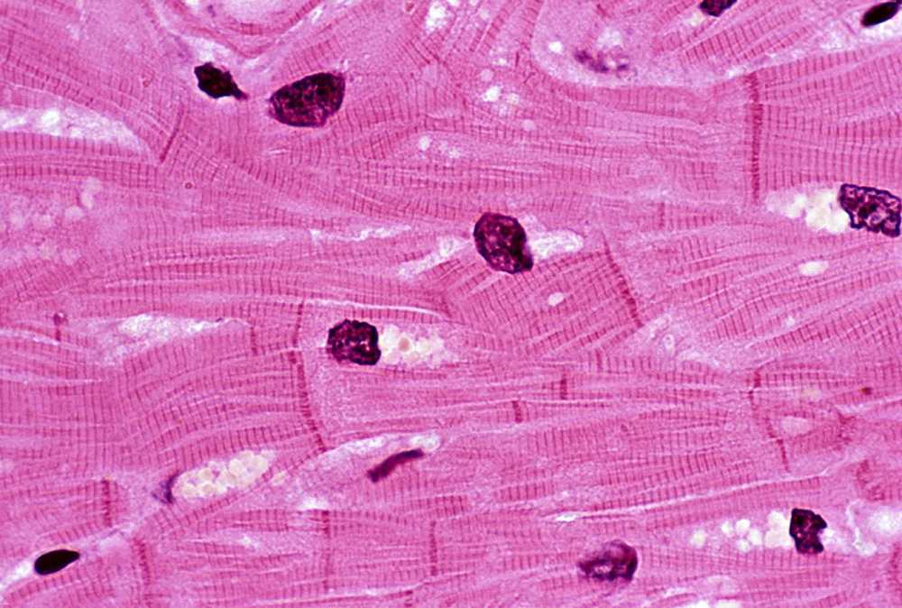Groundbreaking Research Illuminates Role of ART1 in Cardiomyocyte Stress Pathways