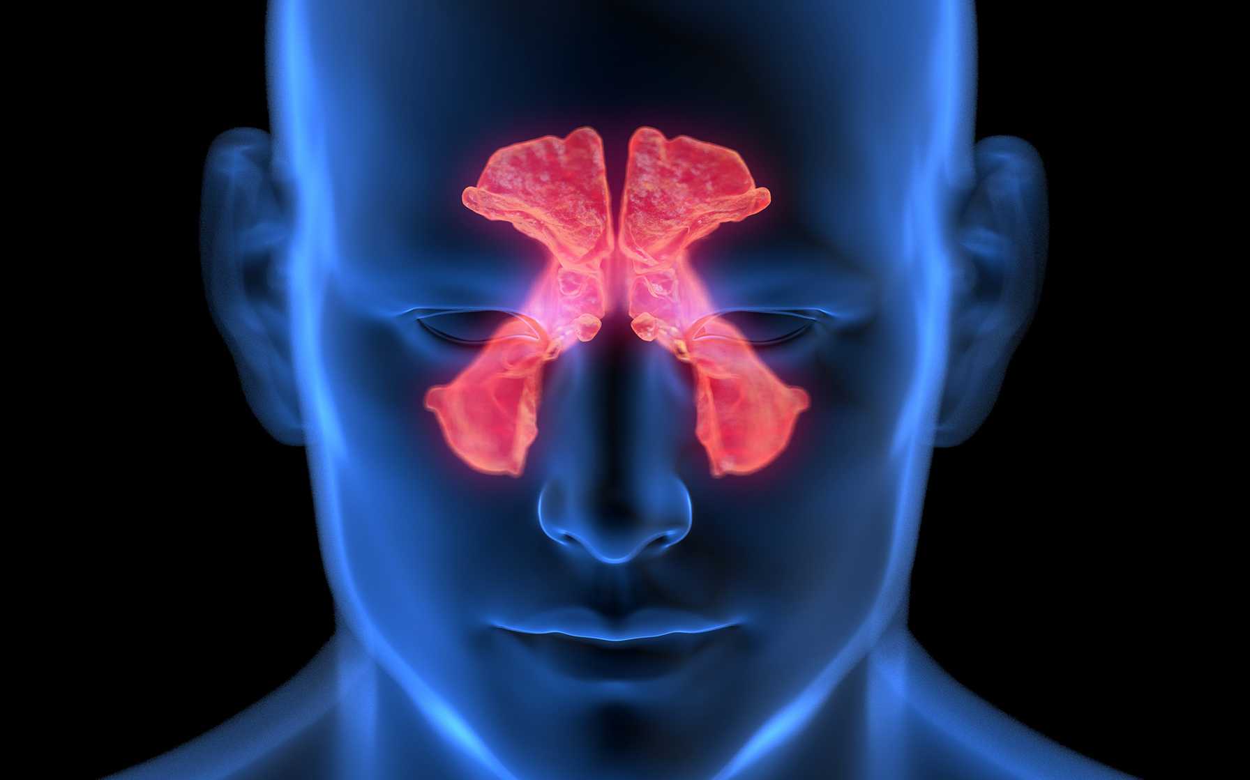 New AAO-HNS Guidelines Mirror Montefiore Einstein’s Proven Approach to Rhinosinusitis