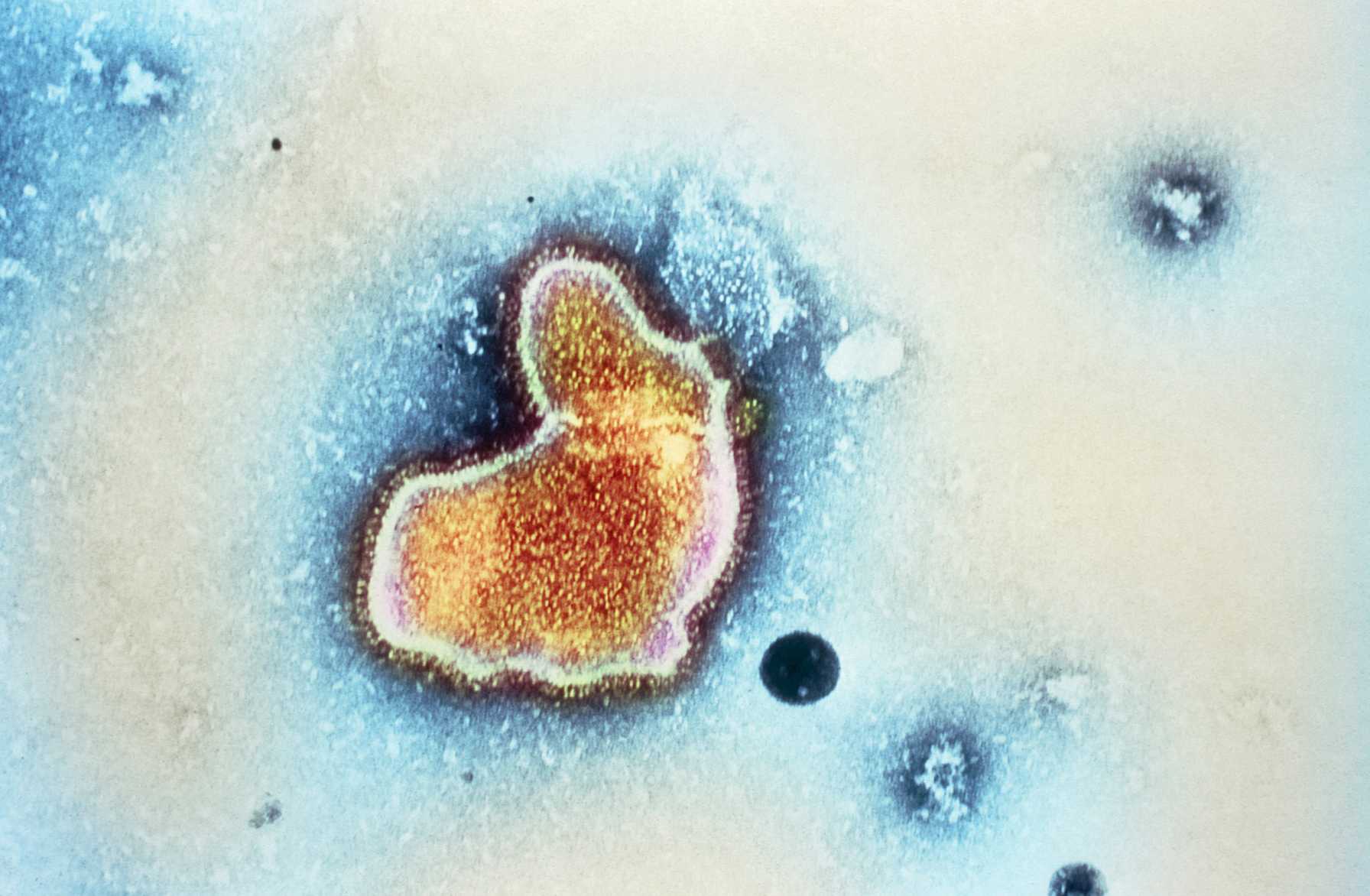 Maternal Respiratory Syncytial Virus (RSV) Vaccination Quality Improvement Initiative 