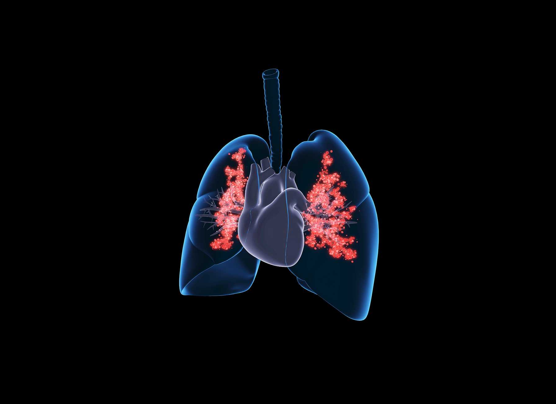 Montefiore Einstein Earns National Recognition for Excellence in Bronchiectasis & Nontuberculous Mycobacterial (NTM) Care.