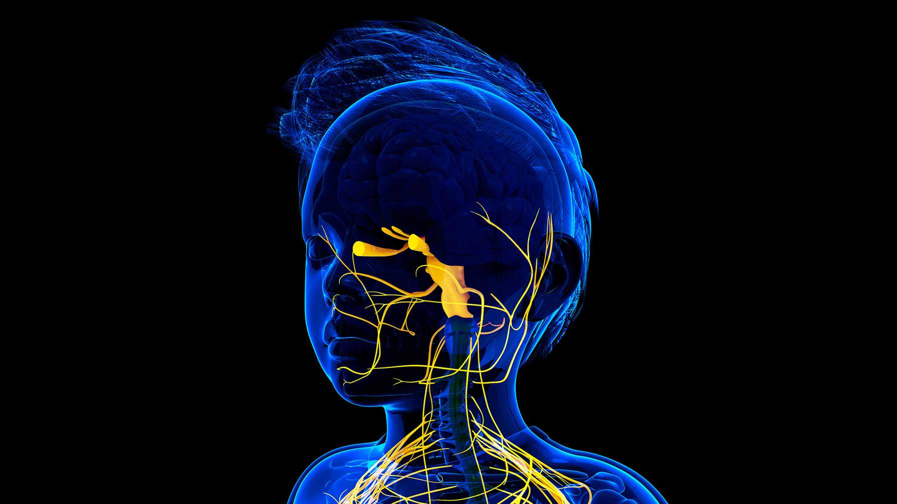 Hypoglossal Nerve Implant Offers Life-Changing Results for Children with Down Syndrome and OSA