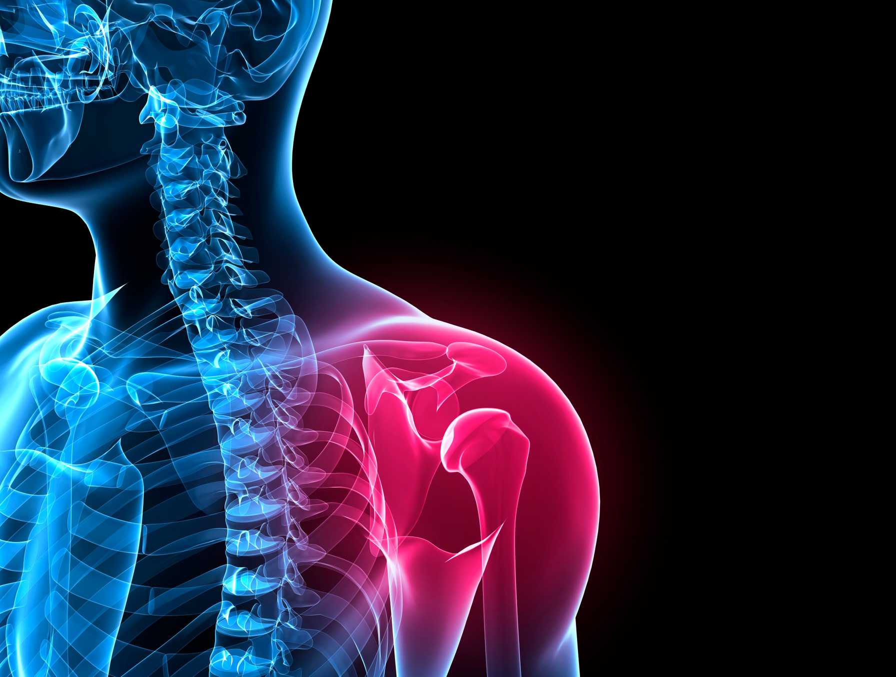 Innovative All-Arthroscopic Procedure for Complex Posterior Shoulder Dislocations