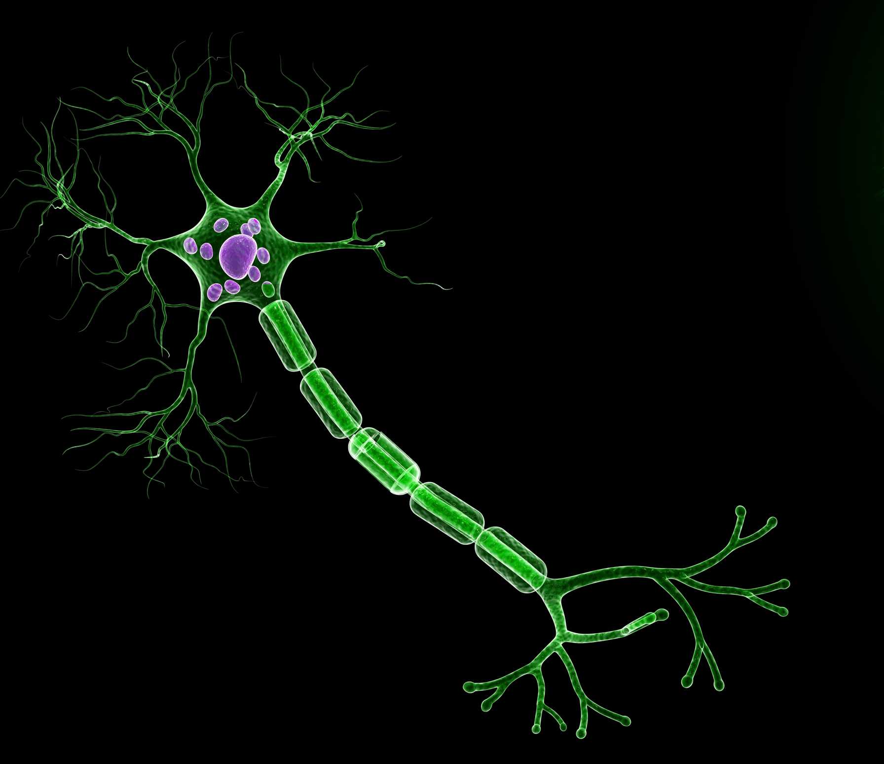 Breakthrough Vagus Nerve Stimulation Technology Paired with Neurorehabilitation Gives Chronic Ischemic Stroke Survivors a New Chance for Recovery