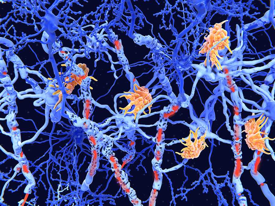 Continuing to Set the Standard for Utilizing Paradigm Shifting Multiple Sclerosis (MS) Scientific Discoveries to Deliver a Spectrum of Precision Medicine Treatment Strategies Across our Diverse Health System Network